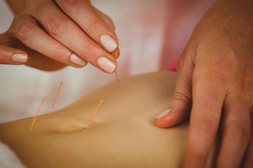 Acupuncture and Acupressure