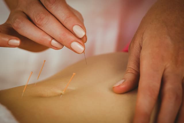 Acupuncture and Acupressure 